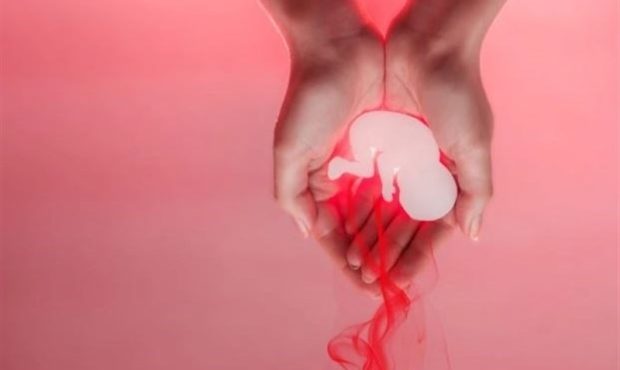 ۳ علت “سقط جنین” در کشور/ سقط تحتتأثیر شعارهای تنظیم خانواده ۳ علت “سقط جنین” در کشور/ سقط تحتتأثیر شعارهای تنظیم خانواده